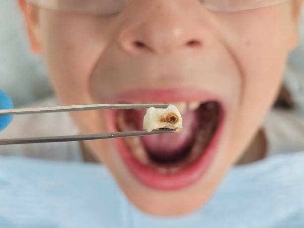 Best Emergency Denture Repair in Hercules, CA