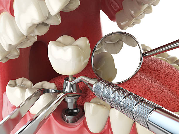Best Emergency Treatment for Jaw Pain or Injury in Hercules, CA